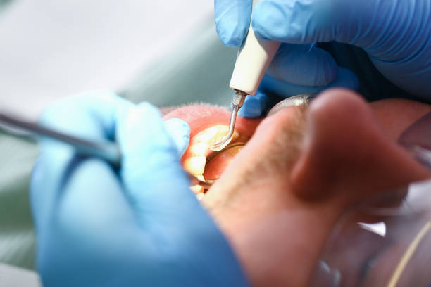 Best Dentist for Tooth Abscess  in Tucson Mountains, AZ